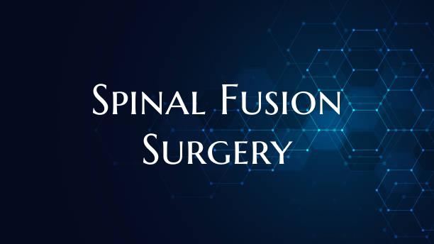 Spinal Fusion Surgery