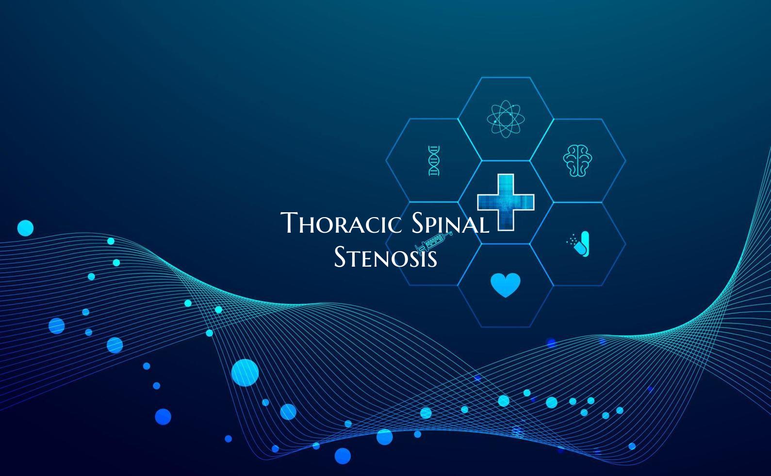 Thoracic Spinal Stenosis