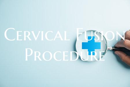 Cervical Fusion Procedure