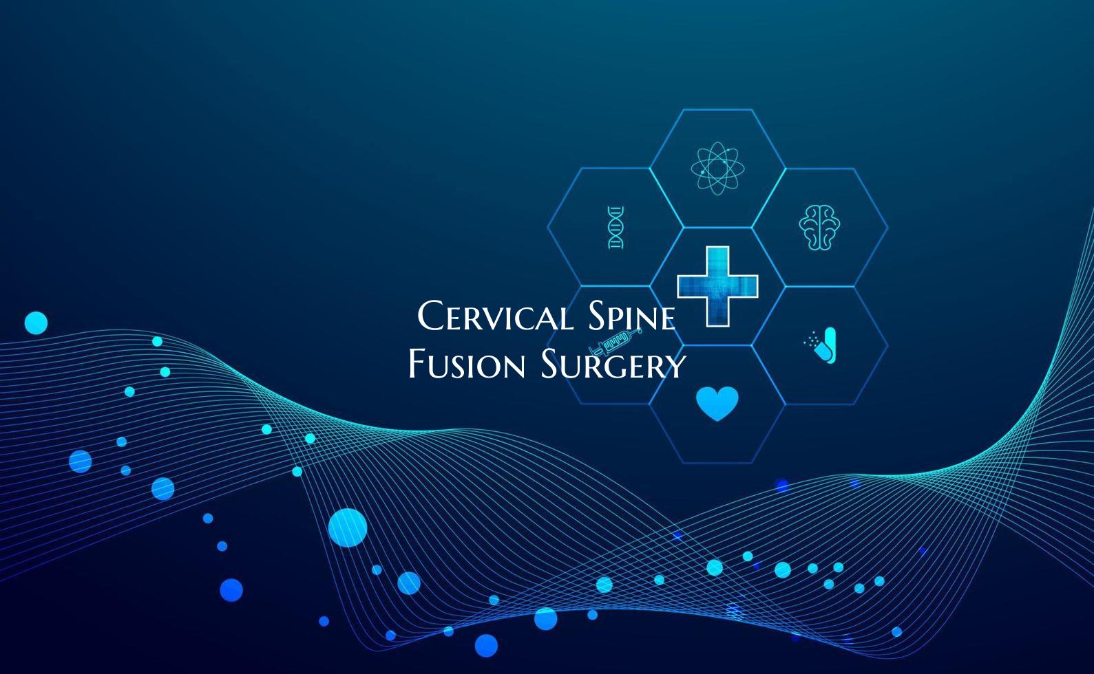 Cervical Spine Fusion Surgery