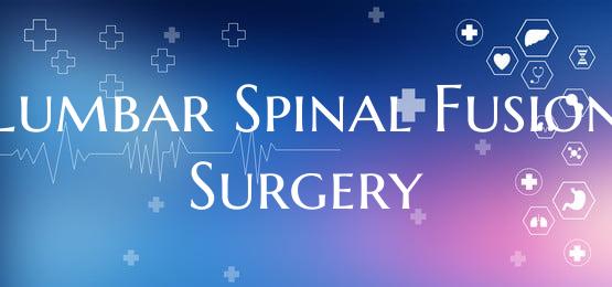 Lumbar Spinal Fusion Surgery