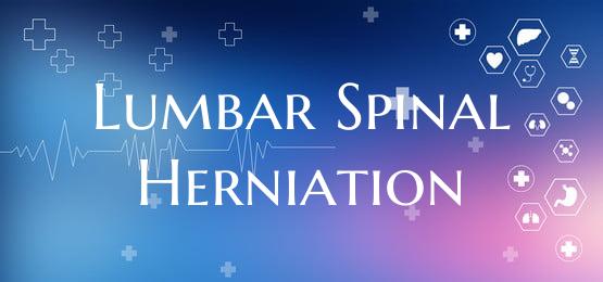 Lumbar Spinal Herniation