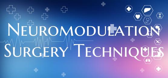 Neuromodulation Surgery Techniques
