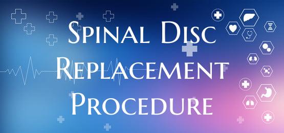 Spinal Disc Replacement Procedure